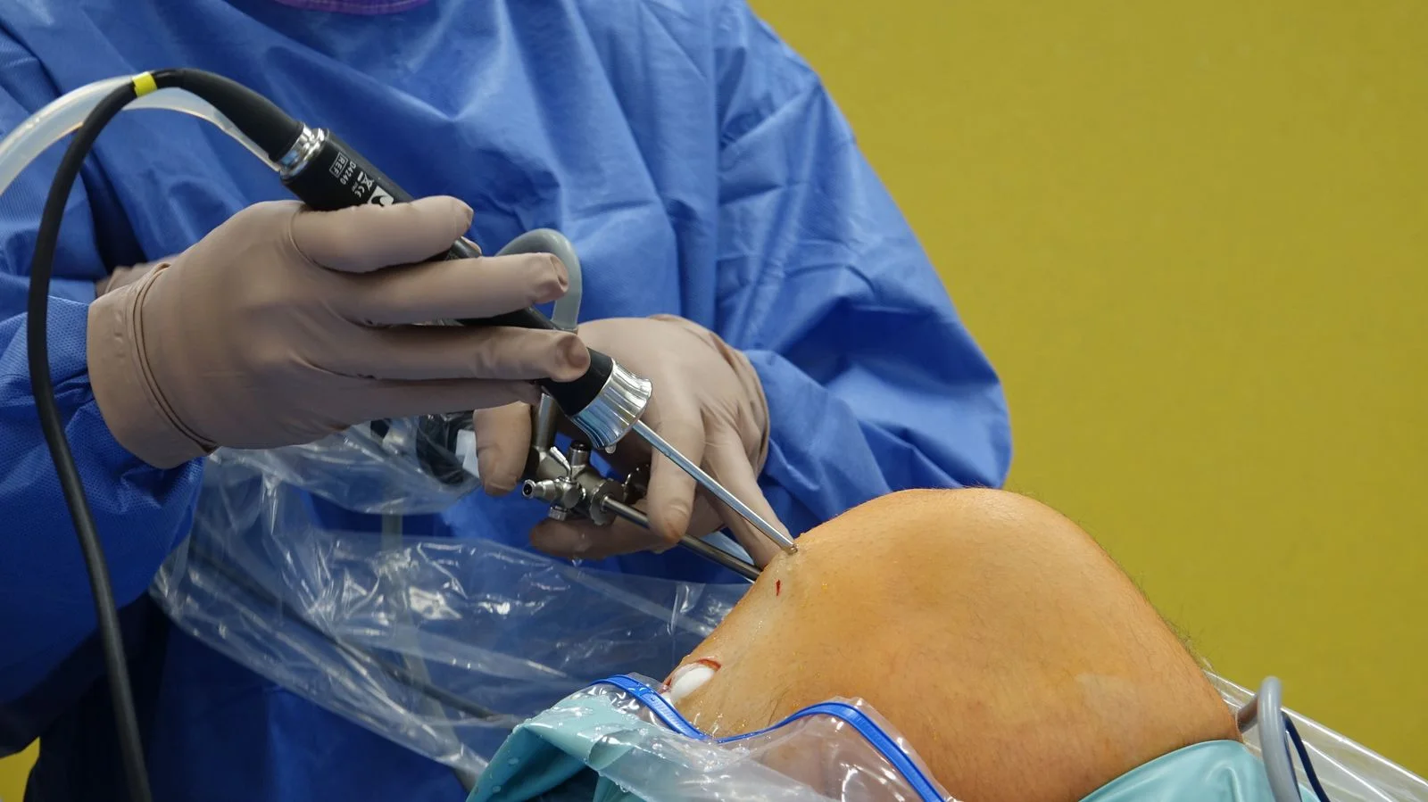 Chirurgo che esegue un’artroscopia di ginocchio con ottica e strumenti